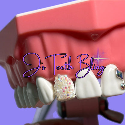 Tooth Gem Starter Kit: 210 Gems, Adhesives, Cure Light, Manual and More!