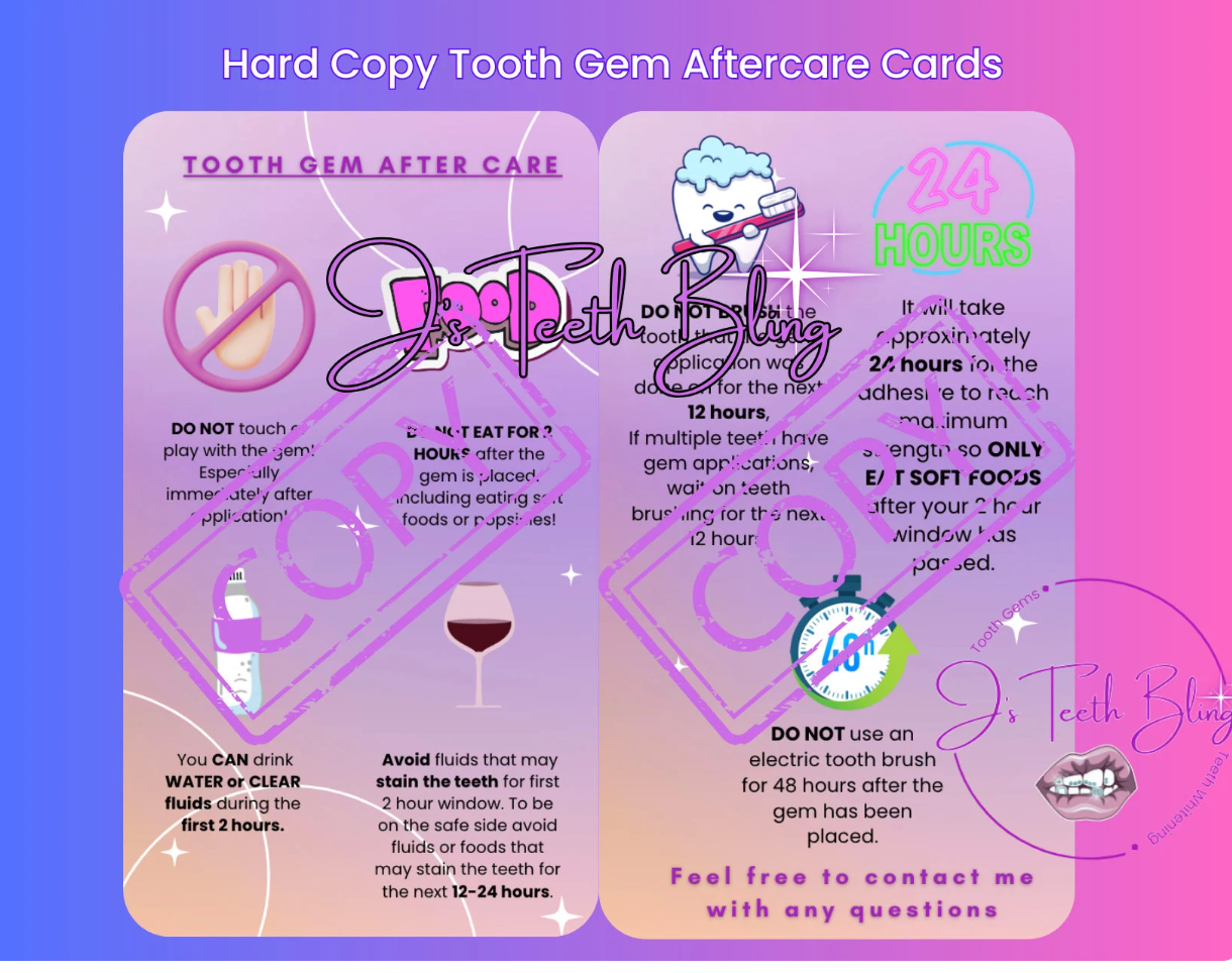 Tooth Gem Starter Kit: 210 Gems, Adhesives, Cure Light, Manual and More!